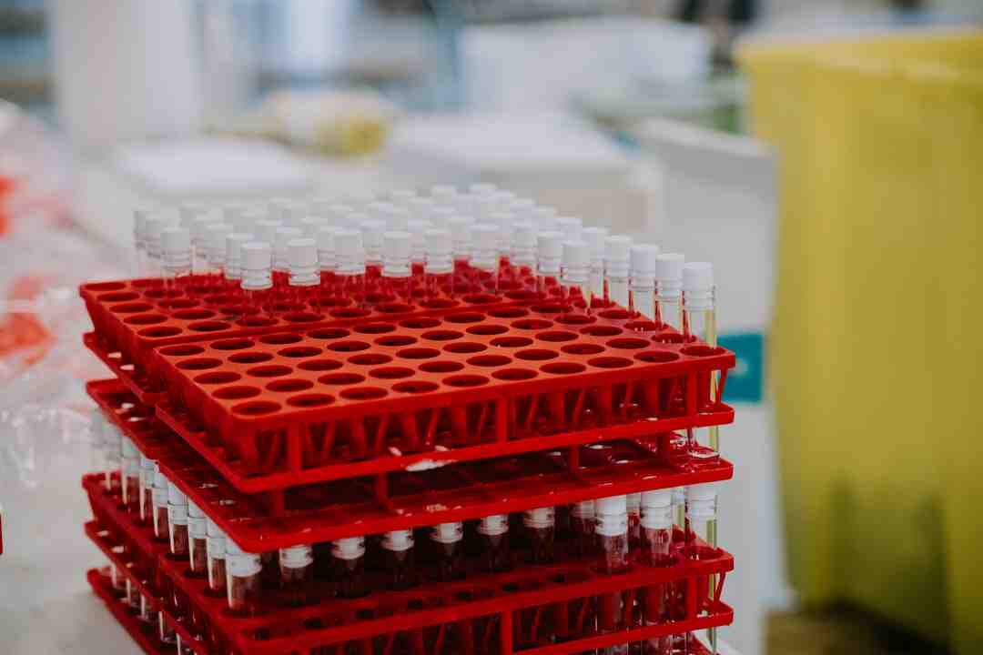 Comment faire cuire à la vapeur sans appareil ?